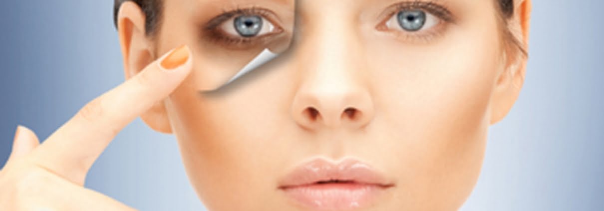 principais tratamentos contra olheiras
